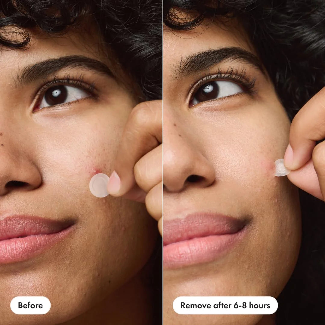 Acne Invisible Patch